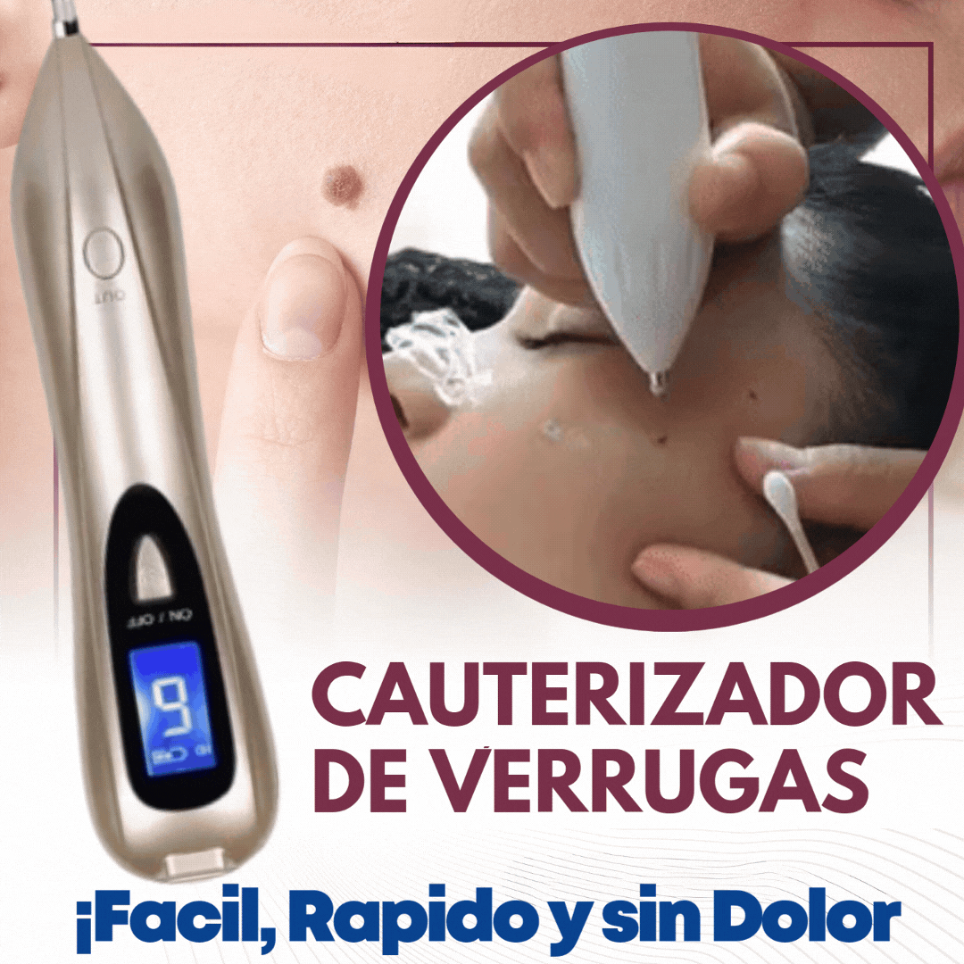 Cauterizador de Verrugas